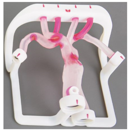 EVIAS Plus - Type III Aortic Arch soldes