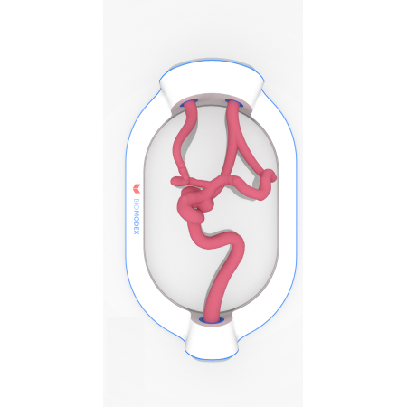 EVIAS-HMS-Cartridge- 458 les ligaments