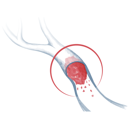 Thrombotech™ - Synthetic Clot Faites des économies